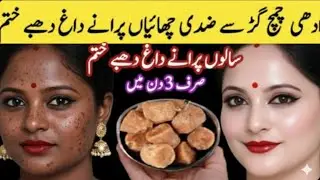 Homemade 0 Cost Skin Whitening Mask | Just One Time Apply All Skin Problems Gone Forever