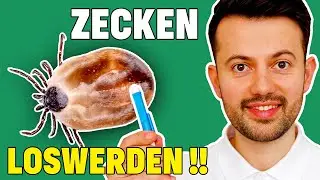 Was hilft am besten gegen Zecken beim Hund?? - Wichtige Tierarzt Tipps!