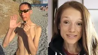 Vegans: The Epitome of Malnourishment 5