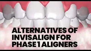 Clear Aligner Invisalign Alternatives for Phase 1 Treatment