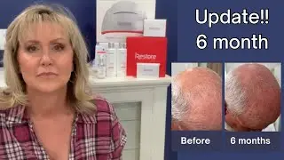 iRESTORE UPDATE!! | 6 Month Update iRESTORE | 6 Month hair Growth Journey