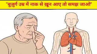 बुढ़ापे में नाक से ख़ून आने का कारण और इलाज | Nose Bleeding in Old Age Treatment in Hindi