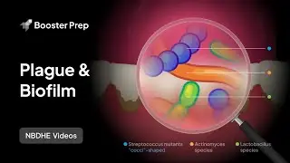 Periodontics | Plaque & Biofilm | NBDHE