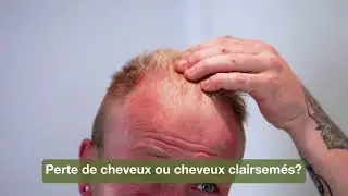 S&eacute;rum contre la chute des cheveux avec Biotine, Capilia Longa et Huile de Tea Tree