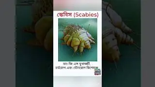 Scabies #dermatologist #skinspecialist #doctor #shorts #bangla