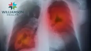 Does Insurance Cover Low-Dose CT Scans with Dr. Tufik Assad