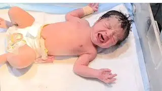 Watch This Baby’s Physiotherapy – So Brave & Adorable 😍