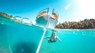 Electric Shock Drowning: A Silent Killer