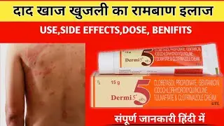पुरानी से पुरानी दाद खाज खुजली की दवा | Dermi 5 Cream | dad khaj khujali ki Best dawa| #medico