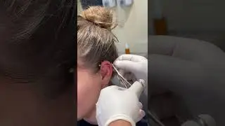 Industrial Piercing: Edgy, Elegant, and Unforgettable ✨💎 #industrialpiercing #earpiercing #dubai