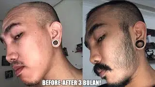 Cara Menumbuhkan Brewok Permanen Tanpa Bakat Brewok