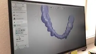Digitale Scantechnik Z&auml;hne