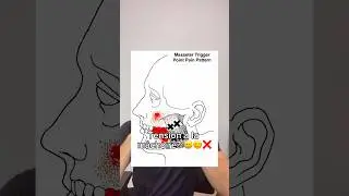 Tension &agrave; la m&acirc;choire ? Cette vid&eacute;o est pour toi ✅ #machoire #douleur #migraine