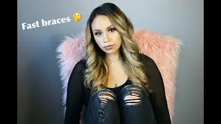 Fast Braces experience