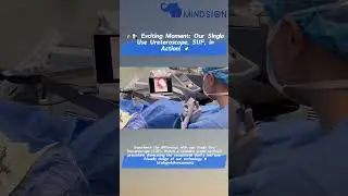 Exploring Our Disposable Ureteroscope:  SUF's Surgical Excellence |Mindsion |Zhuhai Vision Medical