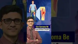 Can 𝐒𝐀𝐑𝐂𝐎𝐌𝐀  be cured without surgery &ndash; 𝐃𝐫. 𝐑𝐚𝐣𝐚𝐭 𝐆𝐮𝐩𝐭𝐚