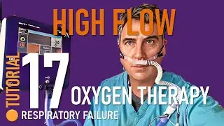 High Flow Oxygen Therapy