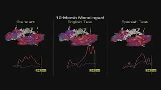 MRI Diffusion/Parcellation of Standard English/Spanish MEG auditory processing of 1yo Monolingual