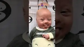 Temu Małżeństwu Urodziło Się Dziecko Z Zespołem Downa🤩❤️