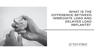 What Is the Difference Between Immediate Load and Delayed Load Implants?