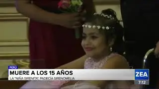 Ni&ntilde;a peruana que naci&oacute; con 