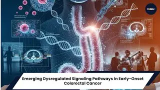 Emerging Dysregulated Signalling Pathways in Early-Onset Colorectal Cancer