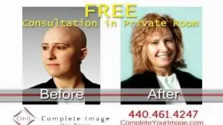 Hair restoration at Complete Image Hair Design - CompleteImage.org