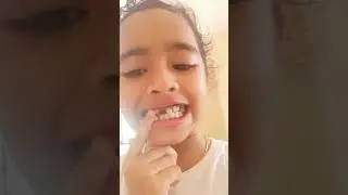 എന്റെ പല്ല് പോയി😅 - Magic Trick failure