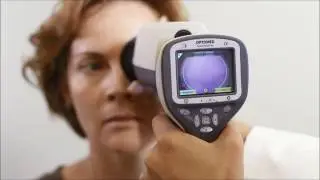 Smartscope PRO with EY4 - Focus modes and aim help