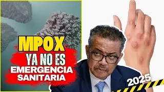 Is monkeypox still dangerous in 2025?