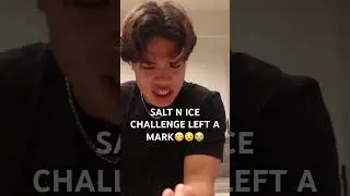 NEVER AGAIN BRO..#salt #ice #challenge #burn #funny