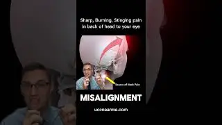 Severe sharp, burning, or stinging pain in the back of your head and scalp?
