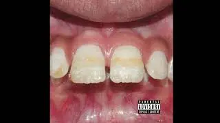 REMEMBER - NOTCASUAL