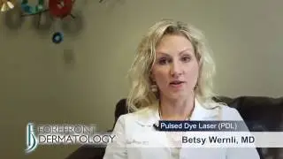 Learn about the Pulsed Dye Laser - Forefront Dermatology