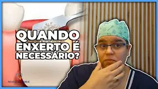 Afinal quando o enxerto &eacute; necess&aacute;rio?| Master Pride Odontologia | Dra Bianca Rosa