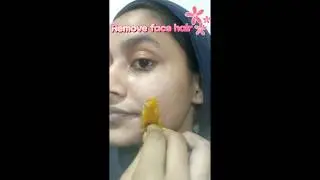 Sugar face hair remove💗🌺 home remedy #trend #sorts #homemade