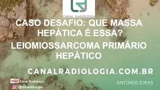 Caso desafio: Que massa hepática é essa? Leiomiossarcoma Hepático Primário
