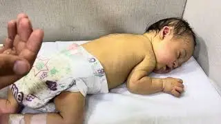 How to Relieve Abdominal Pain in Neonates | Safe NICU Care Techniques
