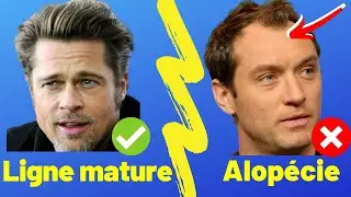 PERTE DE CHEVEUX : CALVITIE OU VIEILLISSEMENT 👴🏾 ?