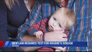 New law requires test for Krabbe's disease