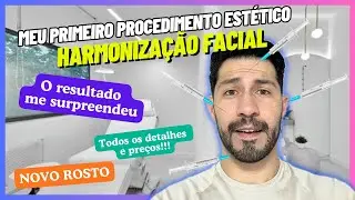 Harmoniza&ccedil;&atilde;o Facial Antes e Depois - Meu primeiro procedimento est&eacute;tico 