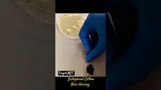 lactophenol cotton blue stain