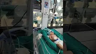 #nicu #tretment #newbornbaby #neonatologist #drlife #doctorlife #drlife #videoshort