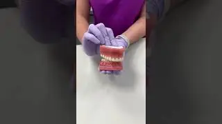 Unpacking the Mystery: This Is a Deep Bite!