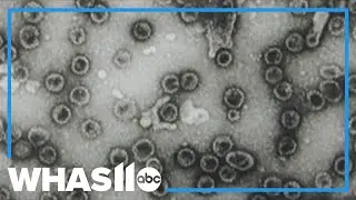 Cervical cancer self-screening now an option for women at average risk
