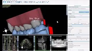 BSP V4.13: Aligner Export Options