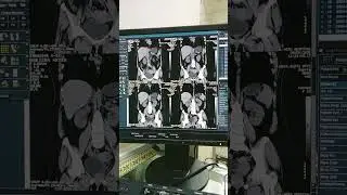NCT of KUB Some Images