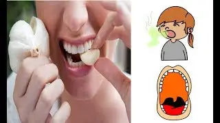 Bad Breath Treatment - How to Remove Garlic Smell from Your Breath and Hands