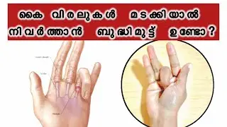 Trigger finger #Triggerfinger #malayalam #physiotherapy #painrehabb #fingerexercises #easyrecovery