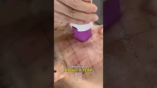 Fine lines, wrinkles, saggy skin? Thermage FLX is the premium RF treatment